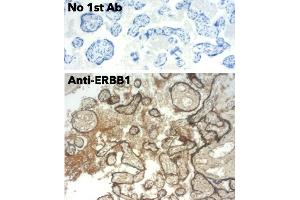 Immunohistochemistry (IHC) image for anti-Epidermal Growth Factor Receptor (EGFR) (C-Term) antibody (ABIN6254171) (EGFR antibody  (C-Term))
