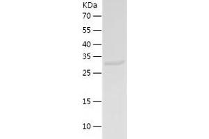 Western Blotting (WB) image for Sulfotransferase Family 1B Member 1 (SULT1B1) (AA 1-296) protein (His tag) (ABIN7284472) (SULT1B1 Protein (AA 1-296) (His tag))