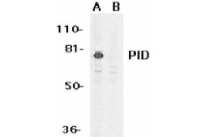Image no. 1 for anti-Metastasis Associated 1 Family, Member 2 (MTA2) (AA 652-668) antibody (ABIN265128) (MTA2 antibody  (AA 652-668))