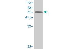 Western Blotting (WB) image for anti-TIMELESS Interacting Protein (TIPIN) (AA 1-301) antibody (ABIN565793)