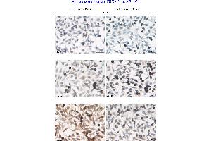 Image no. 3 for anti-F-Box Protein 11 (FBXO11) (Internal Region) antibody (ABIN559708) (FBXO11 antibody  (Internal Region))