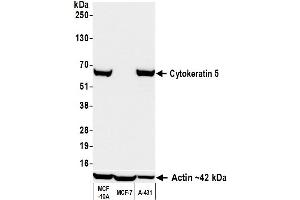 Western Blotting (WB) image for anti-Keratin 5 (KRT5) (C-Term) antibody (ABIN7795754)