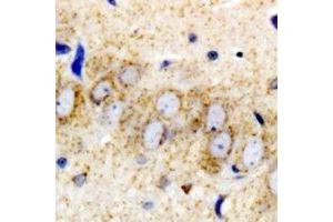 Immunohistochemistry (IHC) image for anti-Ribosomal Protein, Large, p1 (RPLP1) antibody (ABIN7308288) (RPLP1 antibody)