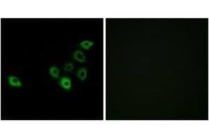 Immunofluorescence analysis of A549 cells, using OR51S1 Antibody.
