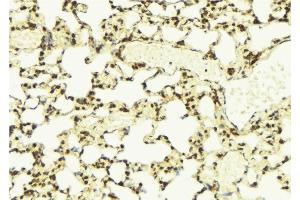 ABIN6275531 at 1/100 staining Mouse lung tissue by IHC-P. (NEK7 antibody  (Internal Region))