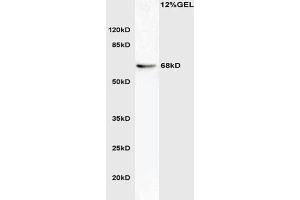 L1 mouse brain lysate probed with Anti phospho-ATG16A(Ser287) Polyclonal Antibody, Unconjugated  at 1:3000 for 90 min at 37˚C. (ATG16L1 antibody  (pSer287))