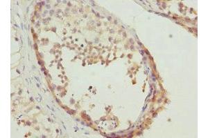 Immunohistochemistry of paraffin-embedded human testis tissue using ABIN7150790 at dilution of 1:100 (TESK2 antibody  (AA 302-571))