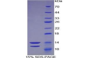 SDS-PAGE analysis of Human Peptide YY Protein. (Peptide YY (PYY) Peptide)