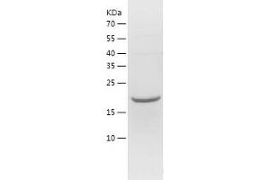 Western Blotting (WB) image for Regulator of G-Protein Signaling 16 (RGS16) (AA 1-202) protein (His tag) (ABIN7284384) (RGS16 Protein (AA 1-202) (His tag))