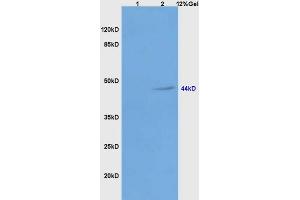 Lane 1: mouse liver lysates Lane 2: human colon carcinoma lysates probed with Anti Galactosidase alpha Polyclonal Antibody, Unconjugated (ABIN872875) at 1:200 in 4 °C. (GLA antibody  (AA 101-200))
