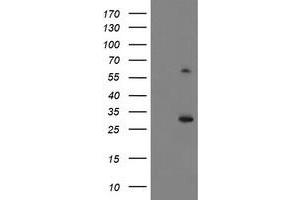 Western Blotting (WB) image for anti-Potassium Channel Tetramerisation Domain Containing 14 (KCTD14) antibody (ABIN1499009)