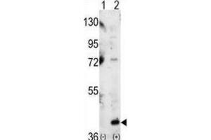 Western Blotting (WB) image for anti-Mitogen-Activated Protein Kinase 14 (MAPK14) antibody (ABIN3003280) (MAPK14 antibody)