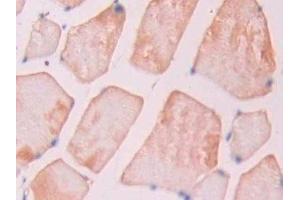 Immunohistochemistry (IHC) image for anti-Lysosomal-Associated Membrane Protein 2 (LAMP2) (AA 191-362) antibody (ABIN7437248)