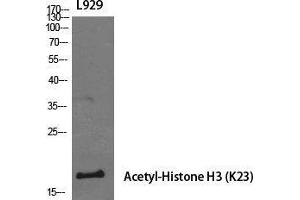 Western Blot (WB) analysis of specific cells using Acetyl-Histone H3 (K23) Polyclonal Antibody. (Histone 3 antibody  (H3K23ac))