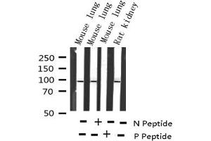 Western blot analysis of Phospho-STAT6 (Thr645) expression in various lysates (STAT6 antibody  (pThr645))