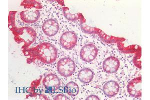 ABIN5539706 (5µg/ml) staining of paraffin embedded Human Colon. (KRT20 antibody  (Internal Region))