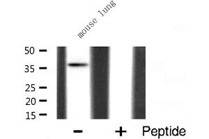 Western blot analysis of hnRNP A2/B1 expression in Mouse lung lysate (HNRNPA2B1 antibody  (N-Term))
