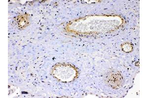 IHC analysis of VEGF Receptor 2  using anti-VEGF Receptor 2  antibody .