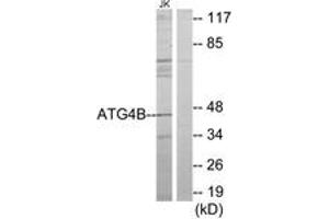 Western Blotting (WB) image for anti-Autophagy related 4B Cysteine Peptidase (ATG4B) (AA 71-120) antibody (ABIN2889829) (ATG4B antibody  (AA 71-120))