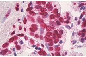 Image no. 1 for anti-High Mobility Group Box 1 (HMGB1) antibody (ABIN1498681)