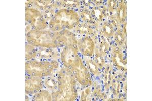 Immunohistochemistry of paraffin-embedded mouse kidney using XIAP antibody (ABIN5974139) at dilution of 1/100 (40x lens). (XIAP antibody)