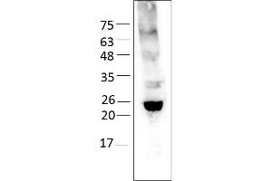 Western Blotting (WB) image for Emopamil Binding Protein (Sterol Isomerase) (EBP) (AA 2-230) protein (rho-1D4 tag) (ABIN3100004)