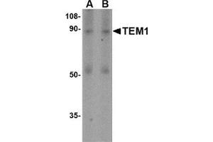 Western blot analysis of TEM1 in human colon tissue lysate with this product at (A) 0. (CD248 antibody  (N-Term))
