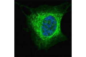 Fluorescent confocal image of SY5Y cells stained with Vimentin antibody at 1:200.