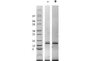 SDS-PAGE of Rat Monocyte Chemotactic Protein-1 (CCL2) Recombinant Protein SDS-PAGE of Rat Monocyte Chemotactic Protein-1 (CCL2) Recombinant Protein. (CCL2 Protein)