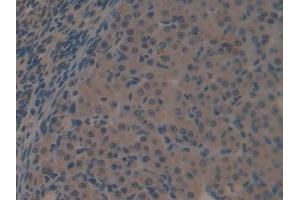 DAB staining on IHC-P; Samples: Mouse Ovary Tissue (Galectin 6 antibody  (AA 1-301))