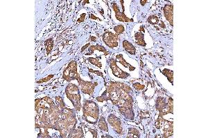 IHC analysis of TOMM34 using anti-TOMM34 antibody (ABIN7599253). (TOMM34 antibody  (AA 1-309))
