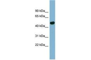 Image no. 1 for anti-EF-Hand Calcium Binding Domain 4B (EFCAB4B) (AA 71-120) antibody (ABIN6741790) (EFCAB4B antibody  (AA 71-120))