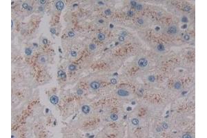Detection of VNN1 in Human Liver Tissue using Polyclonal Antibody to Vanin 1 (VNN1) (VNN1 antibody  (AA 389-497))
