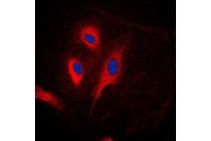 Immunofluorescent analysis of CARD6 staining in Jurkat cells. (CARD6 antibody  (N-Term))