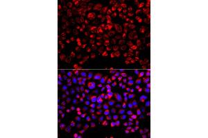 Immunofluorescence analysis of  cells using SULT1E1 antibody (ABIN6129758, ABIN6148714, ABIN6148715 and ABIN6223332). (SULT1E1 antibody  (AA 140-294))