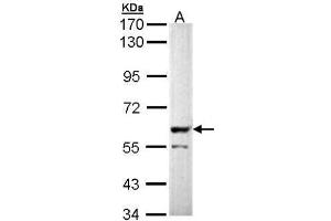 WB Image Sample (30 ug of whole cell lysate) A: Molt-4 , 7. (PPP3CB antibody  (Center))