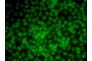 Immunofluorescence analysis of HeLa cells using UMPS antibody. (UMPS antibody)