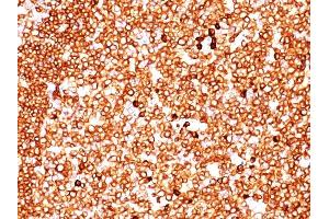 Formalin-fixed, paraffin-embedded human Tonsil stained with CD79a Monoclonal Antibody (SPM549) (CD79a antibody  (AA 202-216))