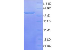 SDS-PAGE (SDS) image for Solute Carrier Family 12 (Potassium-Chloride Transporter) Member 7 (SLC12A7) (AA 1-474), (full length) protein (His tag) (ABIN4976968) (SLC12A7 Protein (AA 1-474, full length) (His tag))