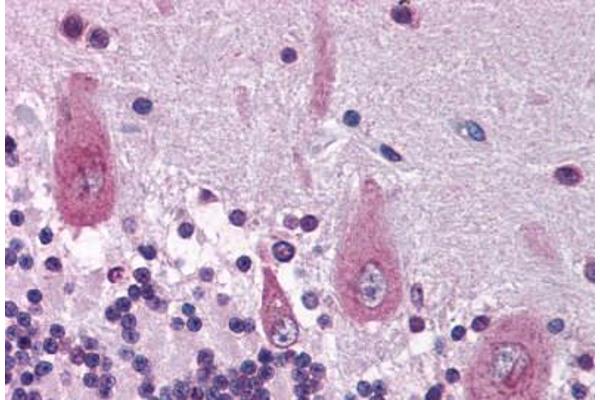 KIF21A antibody  (AA 551-600)