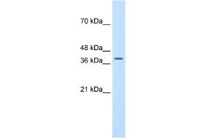 WB Suggested Anti-TFB2M Antibody Titration:  1. (TFB2M antibody  (N-Term))