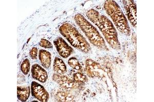 IHC-F testing of VCP antibody and rat intestine tissue (VCP antibody  (C-Term))