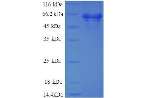 Activator of HSP90 ATPase Activity 1 (AHSA1) (AA 1-338), (full length) protein (GST tag)