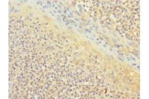 Immunohistochemistry of paraffin-embedded human tonsil tissue using ABIN7171372 at dilution of 1:100 (CD1c antibody  (AA 18-300))