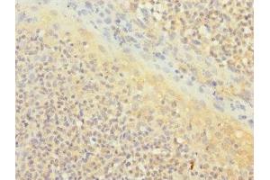 Immunohistochemistry of paraffin-embedded human tonsil tissue using ABIN7171372 at dilution of 1:100 (CD1c antibody  (AA 18-300))