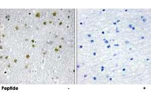 Immunohistochemistry analysis of paraffin-embedded human brain tissue, using NRIP2 polyclonal antibody .