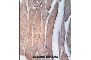 Formalin-fixed and paraffin-embedded human skeletal muscle tissue reacted with DK2 Antibody (N-term V55) 7218a , which was peroxidase-conjugated to the secondary antibody, followed by DAB staining. (DAPK2 antibody  (N-Term))