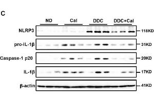 Calcipotriol supplement inhibits the NLRP3 inflammasome activation during DDC-induced and BDL-induced cholestatic liver injury. (NLRP3 antibody  (C-Term))