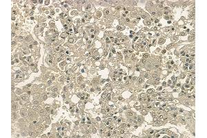 ABIN6255875 and ABIN6267214 at 1/100 staining human normal lung tissue by IHC-P. (CDK6 antibody  (pTyr292))