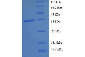 SDS-PAGE (SDS) image for General Transcription Factor IIH, Polypeptide 5 (GTF2H5) (AA 1-71), (full length) protein (GST tag) (ABIN5709629)